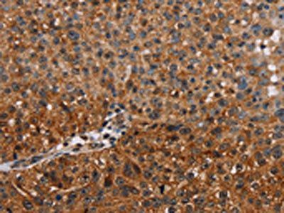 NMT2 Antibody