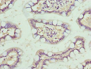 NMU Antibody