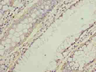 NMUR1 antibody