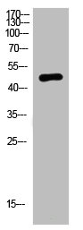NMUR2 antibody
