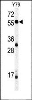NOB1 antibody