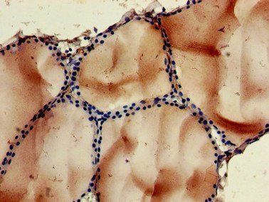NOB1 Antibody