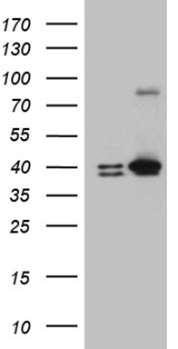 NOBOX antibody