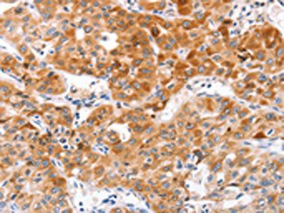 NOD1 Antibody