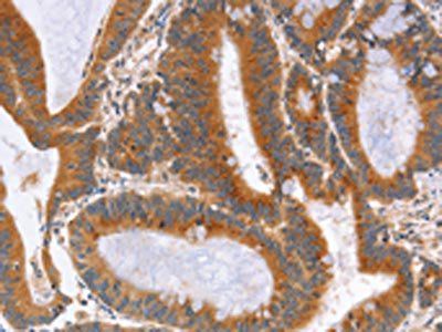 NOD1 Antibody