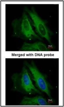 NOD1 antibody