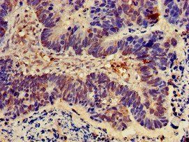 NOD2 Antibody