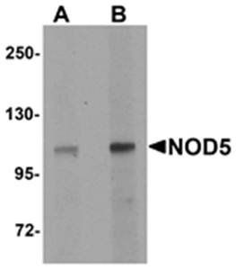 NOD5 Antibody