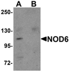 NOD6 Antibody