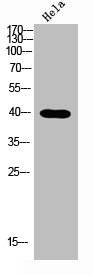 NODAL antibody