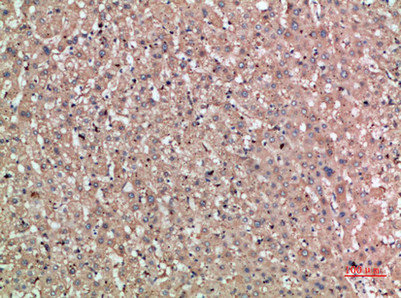 Noggin antibody