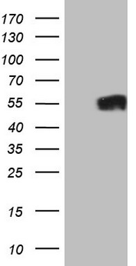 Nogo B receptor (NUS1) antibody