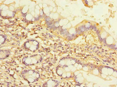 NOL10 Antibody