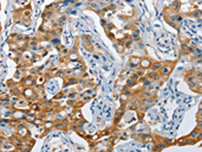 NOL3 antibody