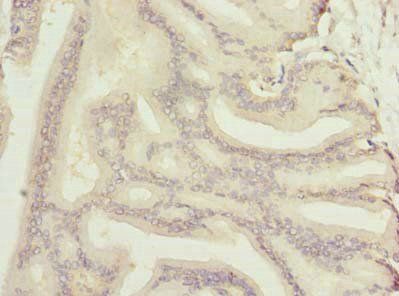 NOL6 Antibody