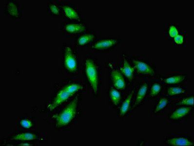 GSDME Antibody