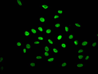 NONO Recombinant Monoclonal Antibody