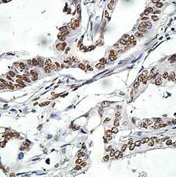 NONO Rabbit Polyclonal Antibody
