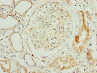 NOP10 Antibody
