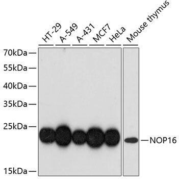 NOP16 antibody