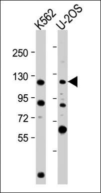 NOP2 antibody