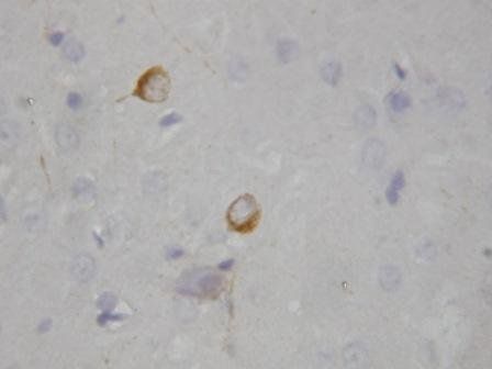 Anti-nNOS (neuronal)/NOS1 Antibody
