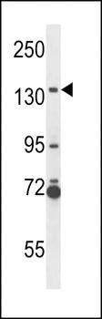 NOS2A antibody