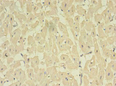 NOSTRIN antibody