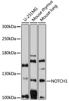 NOTCH1 antibody