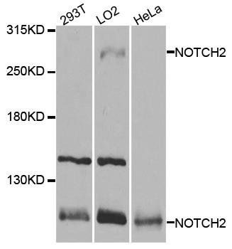 NOTCH2 antibody