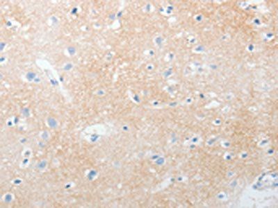 NOTCH2 Antibody