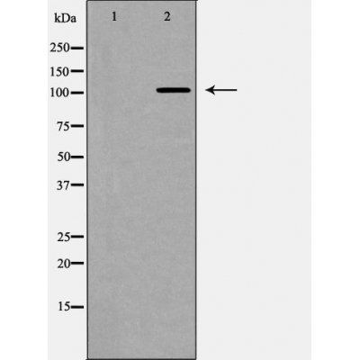 NOTCH2 (Cleaved-Asp1733) antibody