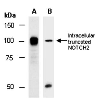 NOTCH2 antibody