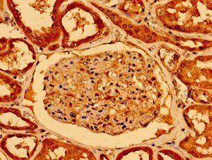 NOTCH2 Antibody