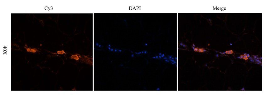 NOTCH3 antibody