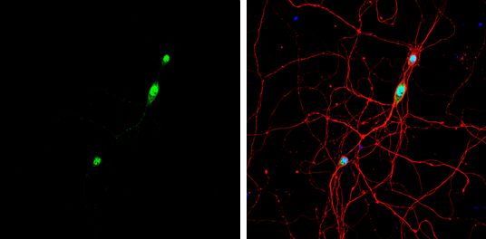 NOVA1 antibody