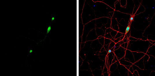 NOVA alternative splicing regulator 1 Antibody