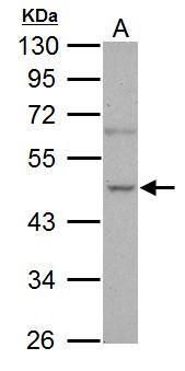 NOVA1 Rabbit Polyclonal Antibody