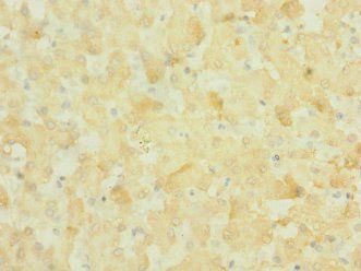 NOX3 Antibody