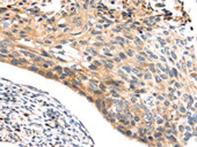 NOX3 Antibody