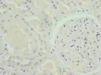 NOX4 antibody