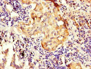 NOXA1 Antibody