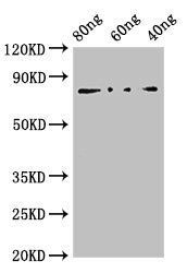 NP antibody