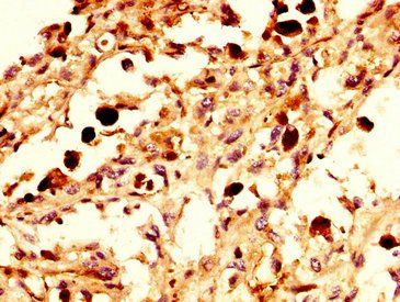 NPAS4 Antibody