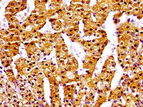 NPC1 Antibody