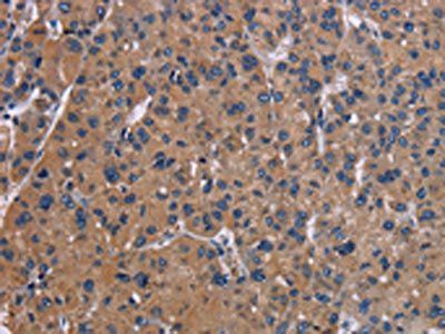 NPC1 Antibody
