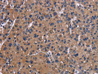 NPC1 antibody