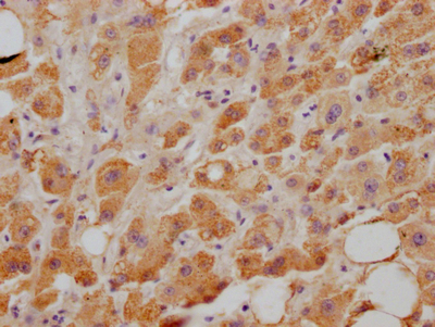 NPC1L1 Recombinant Monoclonal Antibody