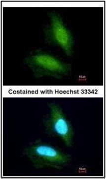 NPEPPS Rabbit Polyclonal Antibody