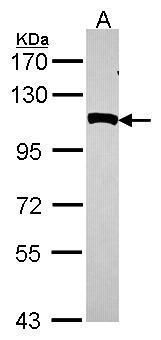NPEPPS Rabbit Polyclonal Antibody